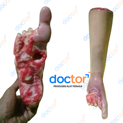 Kaki Luka-Manikin/Manekin Alat Peraga Pendidikan Kaki Luka Bahan Silikon