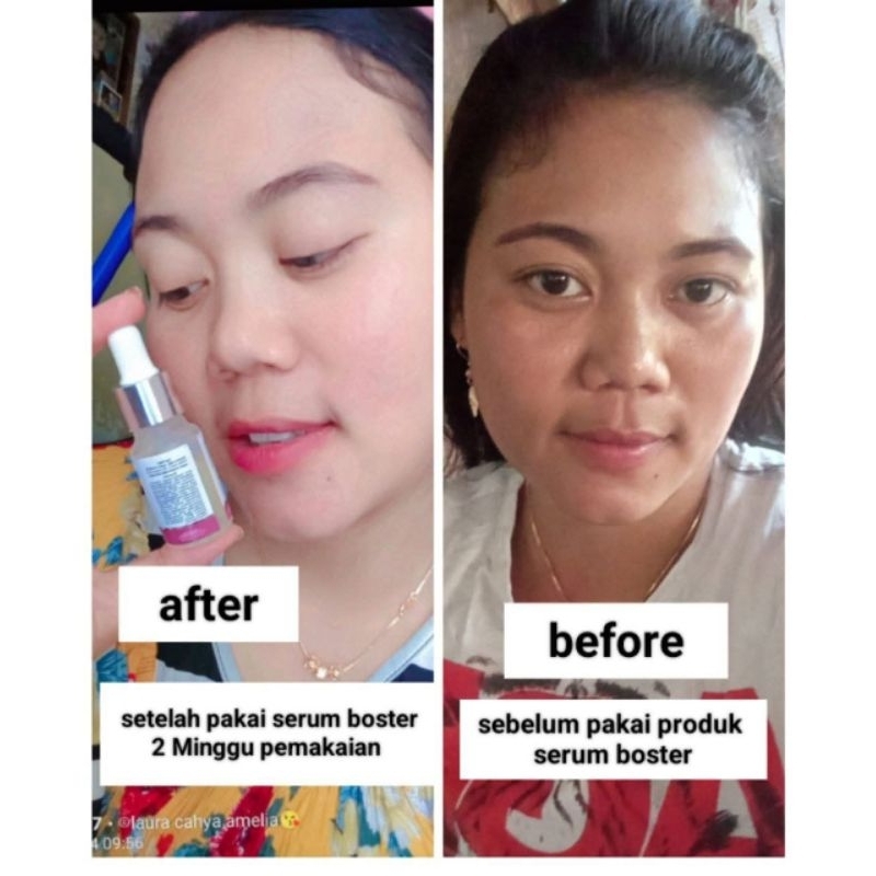 Booster Serum NYRTEA