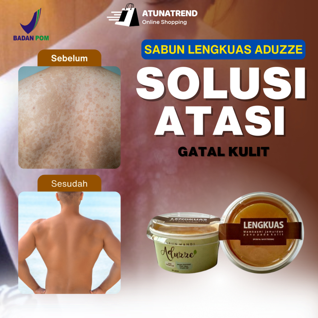 Sabun Lengkuas Penghilang Panu Paling Ampuh Obat Gatal Kadas Kurap Sabun Panu Original 100%