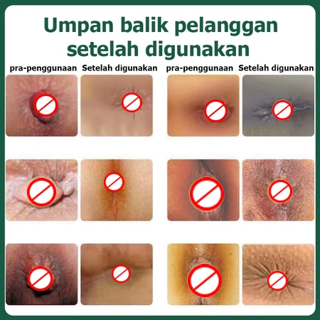 Obat ambien Salep wasir ampuh asli china Salep ambeien paling ampuh Obat wasir 30ml salep ambeyen