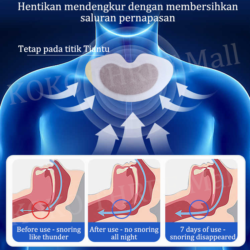 Anti ngorok saat tidur anti dengkur Anti Mendengkur Anti-snoring patch alat anti ngorok saat tidur