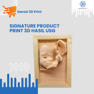 Print 3D Hasil USG bayi_nyata