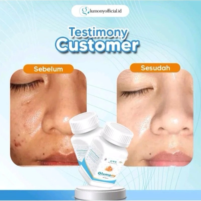 GLUMONY WHITENING - MEMBANTU MEMUTIHKAN BADAN DAN WAJAH GLUMONY PEMUTIH BADAN KOREA | GLUMONY WHITEN