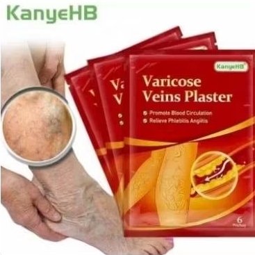 Koyo varicose vein herbal healing patch koyo varises