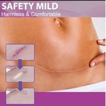 Scar remover cream penghilang scar bekas luka atau koreng 50gr