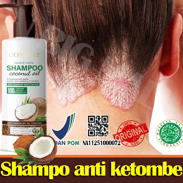 Shampo anti ketombe Sampo anti gatal and ketombe Anti dandruff shampoo 500ml Obat Ketombe Sampo Psor