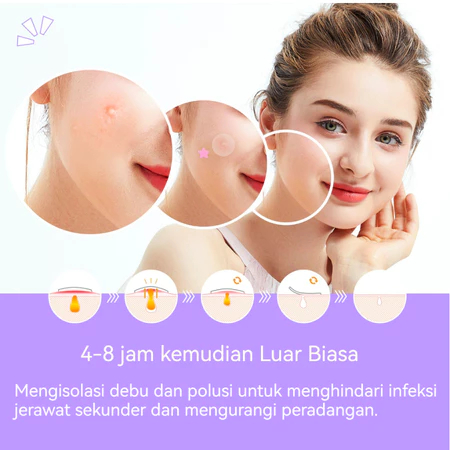 Stiker Jerawat Star Bintang Hydrocolloid Acne Patch / Acne Patch