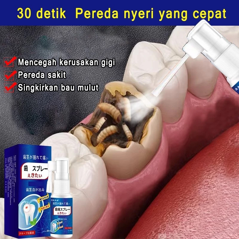 Obat sakit gigi Obat sakit gigi berlubang Obat sakit gigi semprot Obat sakit gigi ampuh Obat sariawa