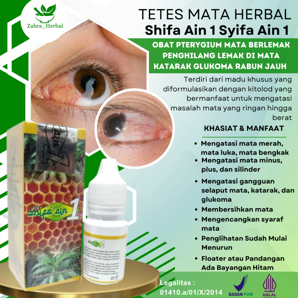 Obat Pterygium Mata Berlemak Penghilang Lemak di Mata Katarak Glukoma rabun jauh Dekat ASli Original
