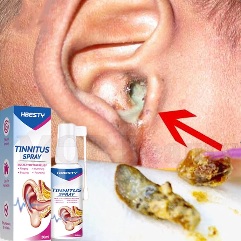 obat tetes telinga Cairan Pembersih Telinga obat sakit telinga Pembersih Kotoran Telinga obat teling