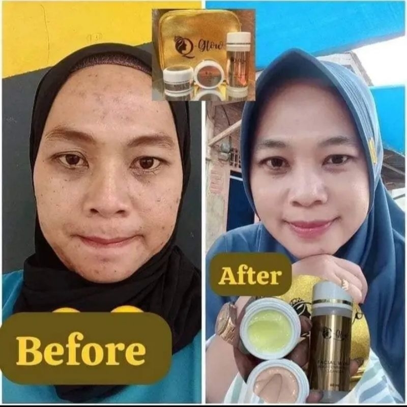 Q glow Skincare