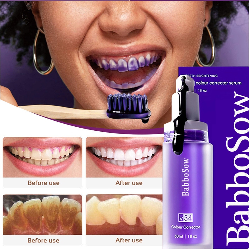 Pasta Gigi Smile Ease V34 Pemutih Warna yang Tepat Penghilang Karang Gigi 30ML