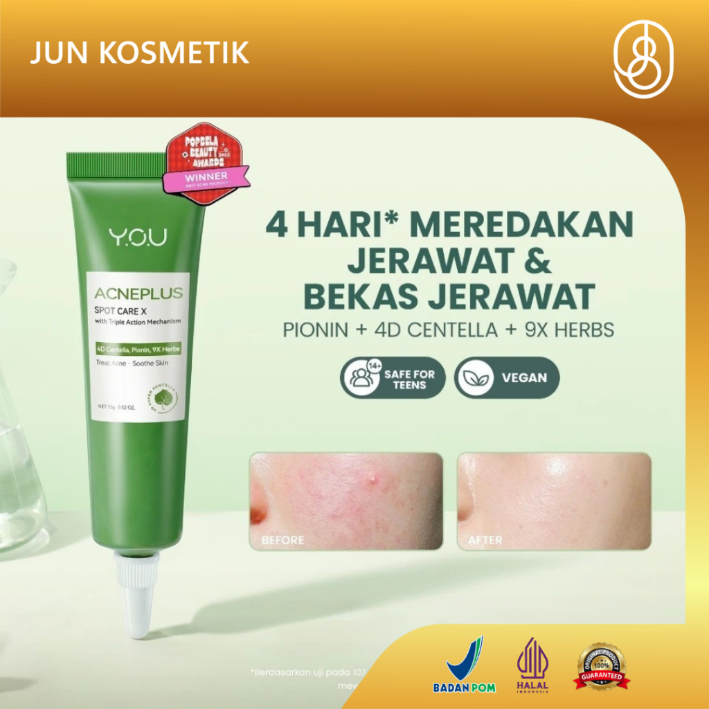 YOU AcnePlus Spot Care X Obat Totol Jerawat Obat Jerawat Obat Bekas Jerawat