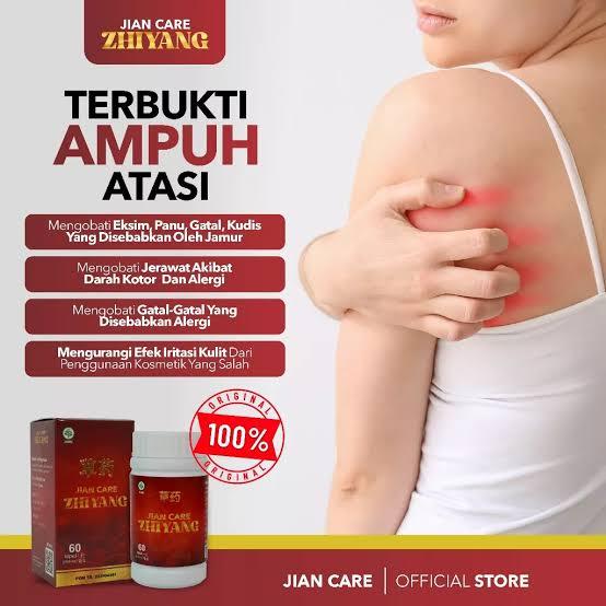 Jian Care Zhiyang - Obat Herbal Cina Untuk Meredakan Rasa Gatal Pada Kulit