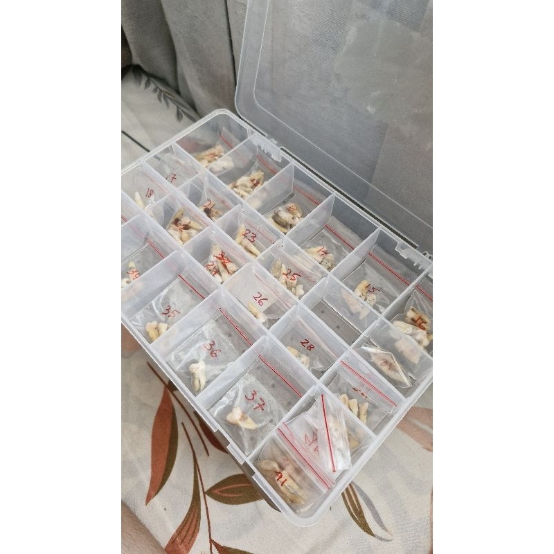 Gigi Asli (Incisivus, Caninus, Pre Molar, Molar, Gigi Sulung, Gigi lubang) Rahang atas dan Rahang ba