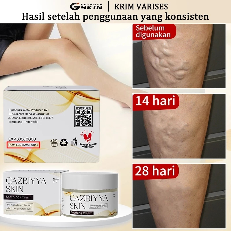 Valesin varises Obat varises Salep varises paling ampuh 30g obat varises original obat varises di