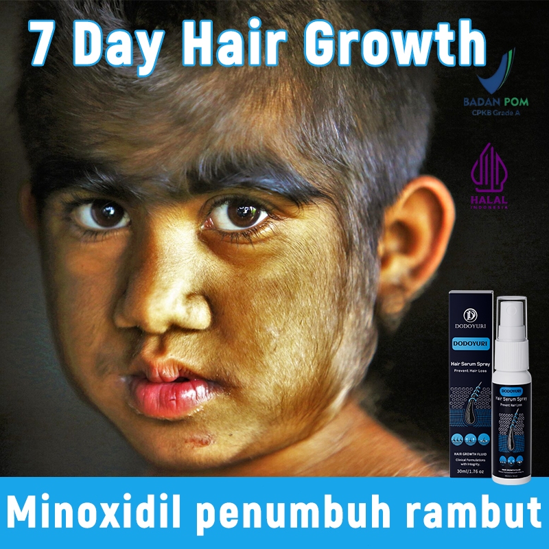 Obat penumbuh rambut hair tonic rambut rontok serum rambut rontok penumbuh rambut cepat 30ml penumbu