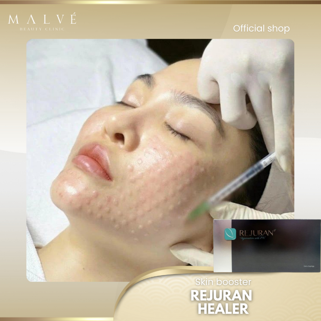 Malve Rejuran Healer