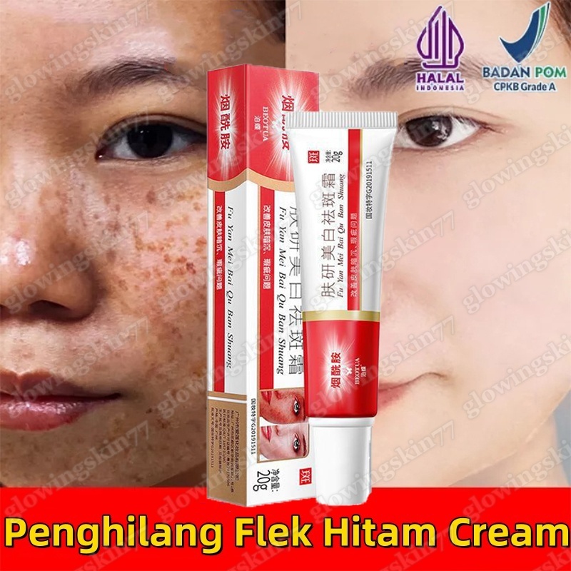 Cream Penghilang Flek Hitam Cream 20g Pemutih Wajah Niacinamide Whitening Freckle Cream Remove Melas