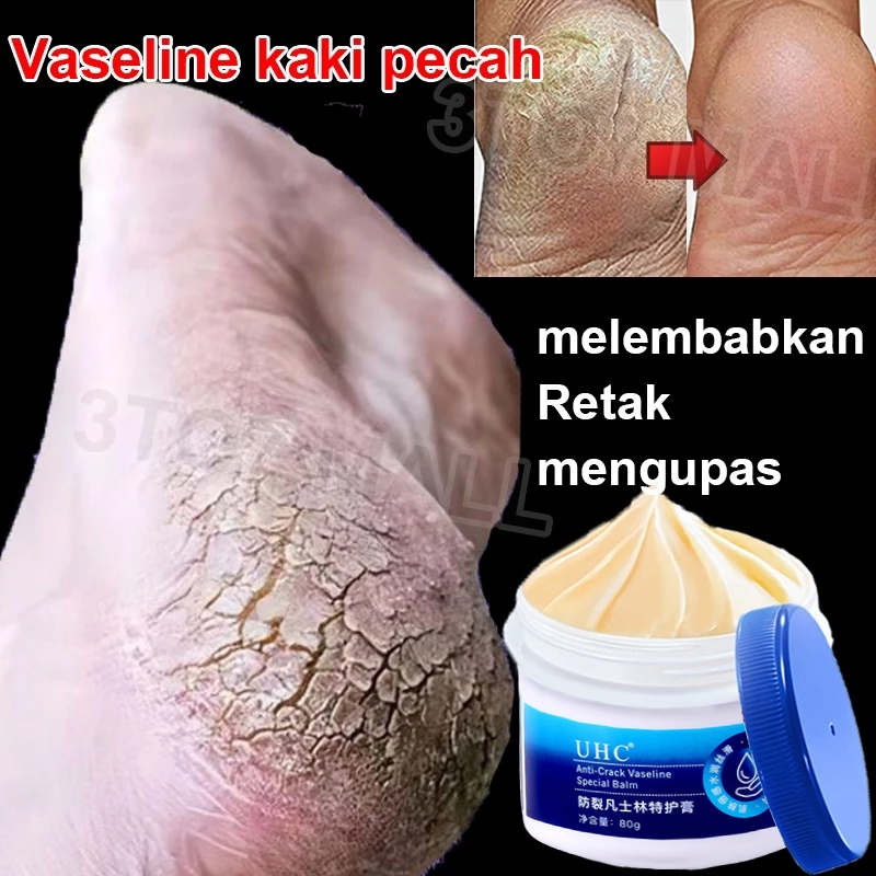 Vaseline cream kaki Krim Pelembap Kaki Kering dan Pecah-Pecah untuk Tumit Kaki pecah dan kering krim