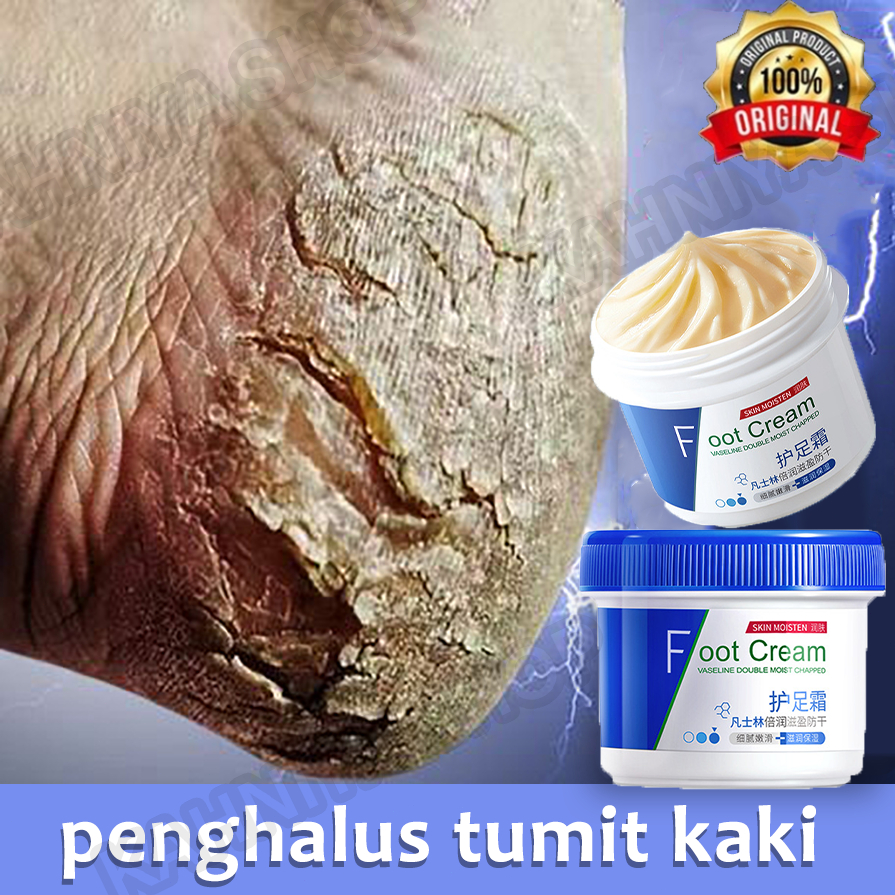 tumitku obat kaki pecah penghalus tumit kaki alat penghalus tumit kaki salep kaki pecah dan kering a