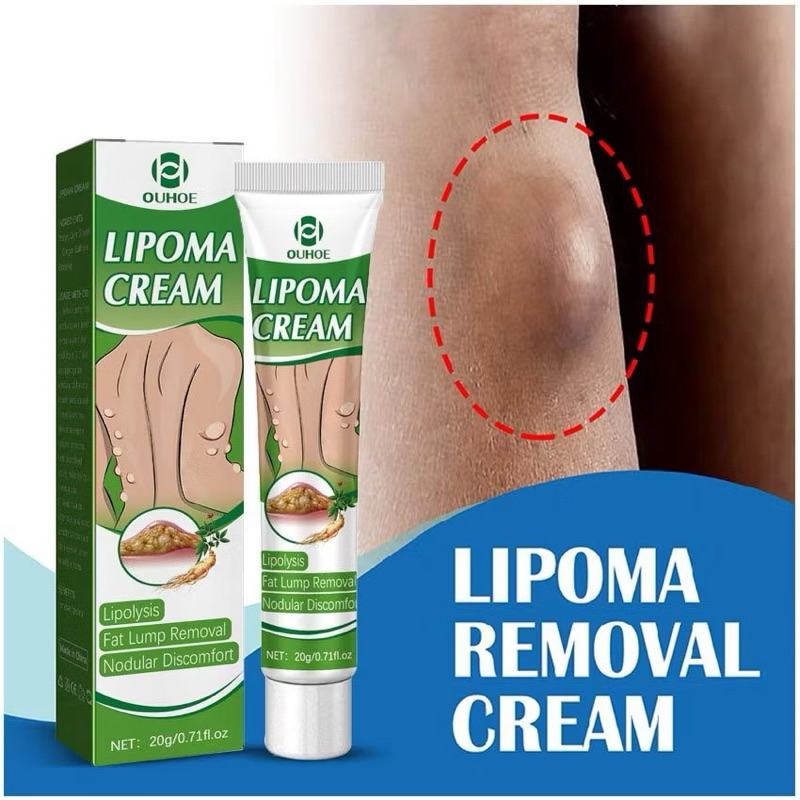 LIPOMA CREAM REMOVAL SALEP BENJOLAN LIPOMA ORIGINAL BPOM HALAL
