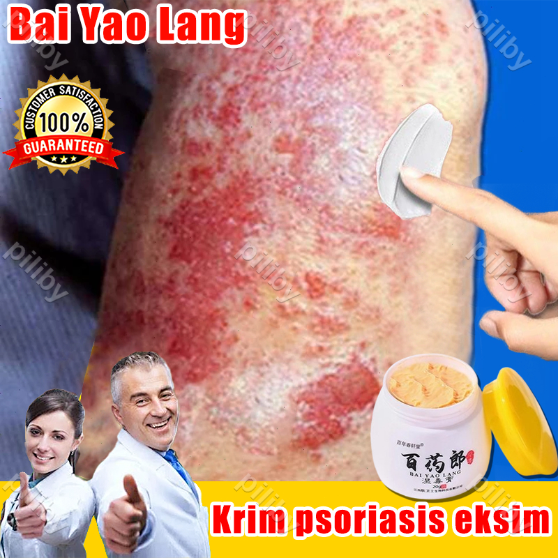 salep eksim paling ampuh salap china untuk gatal gatal obat gatal seluruh badan menghilangkan gatal 