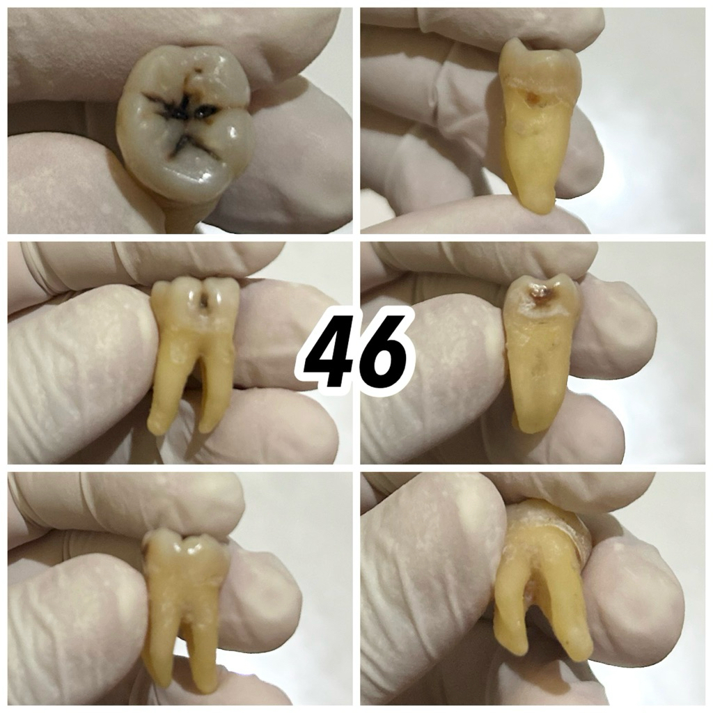 JUAL GIGI ASLI PRAKTIKUM / GIGI MANUSIA / KEDOKTERAN GIGI