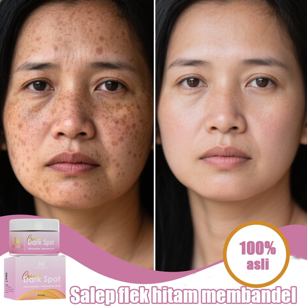 【BPOM】Salep flek hitam membandel menghilangkan flek hitam di wajah krim pemutih wajah bpom 30g