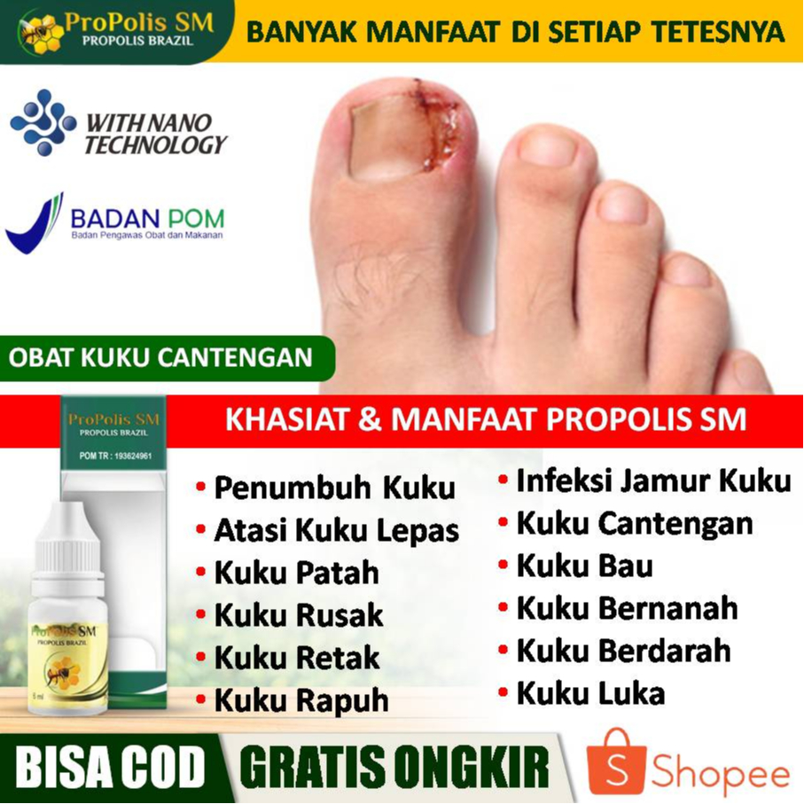 Obat Penumbuh Kuku, Kuku Patah, Kuku Rusak, Kuku Lepas, Infeksi Kuku, Kuku Bau, Kuku Cantengan, Infe