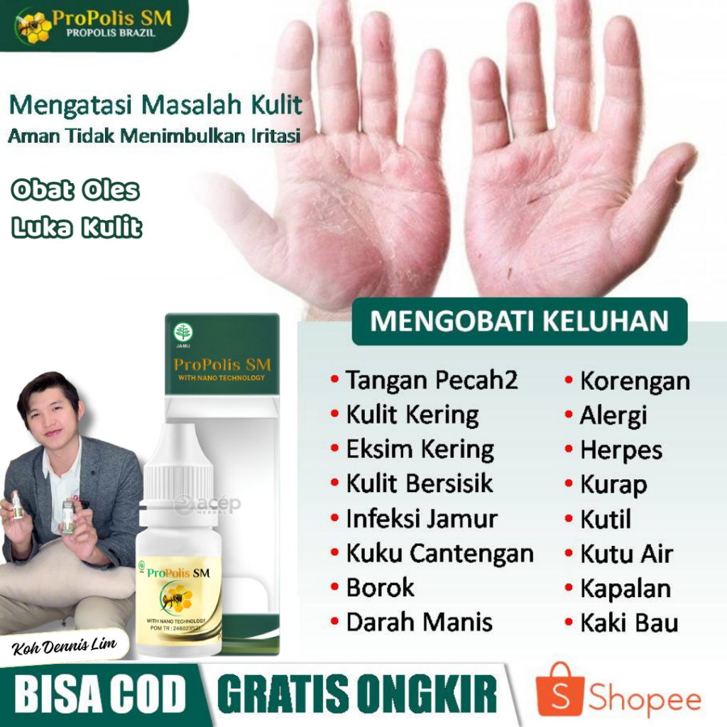 Salep Propolis untuk Tangan Kasar, Pecah-Pecah, Kulit Mengelupas, Eksim Kering, dan Masalah Kulit La