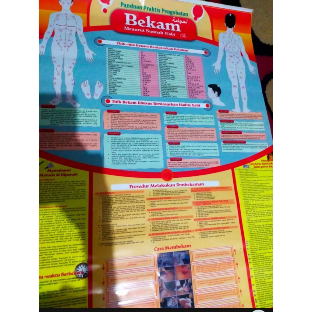 Poster Bekam, Poster Titik Bekam, Poster Panduan Bekam, Poster Dasar Bekam