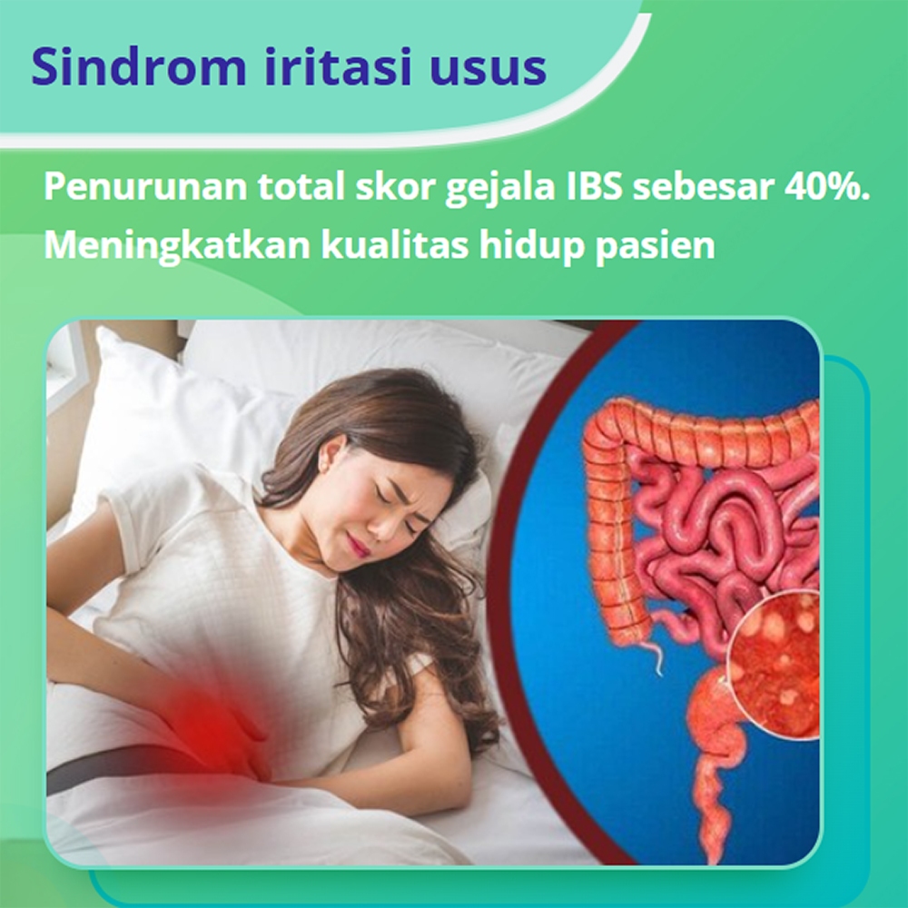 

HerbalBiosure A+ Susu Bubuk Organik 12 Sachet – Probiotik untuk Gangguan Pencernaan & Kolitis Dewasa