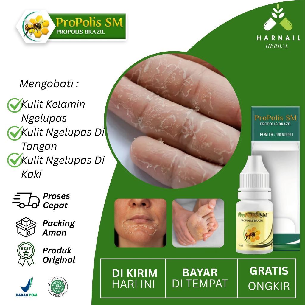Propolis sm obat kulit kelamin kering mengelupas ,kulit kering mengelupas Di Tangan ,kulit kering me