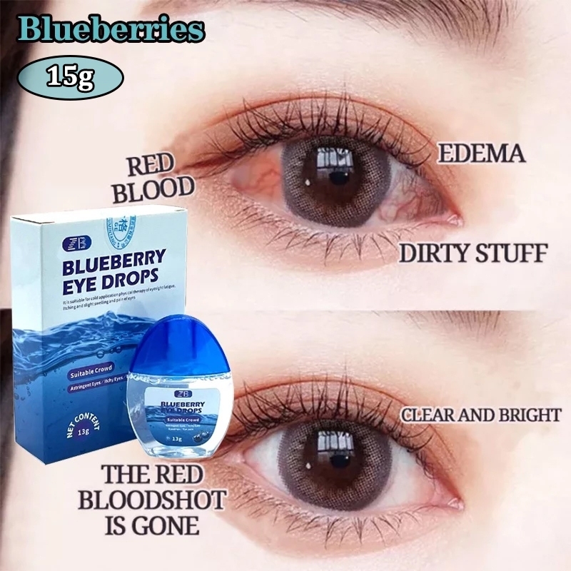 COD Blueberry Eye Drops | Itchy Eyes | Glaucoma | Eye Drops | Dry Eyes | Eye Drops | Sore Eyes 15g
