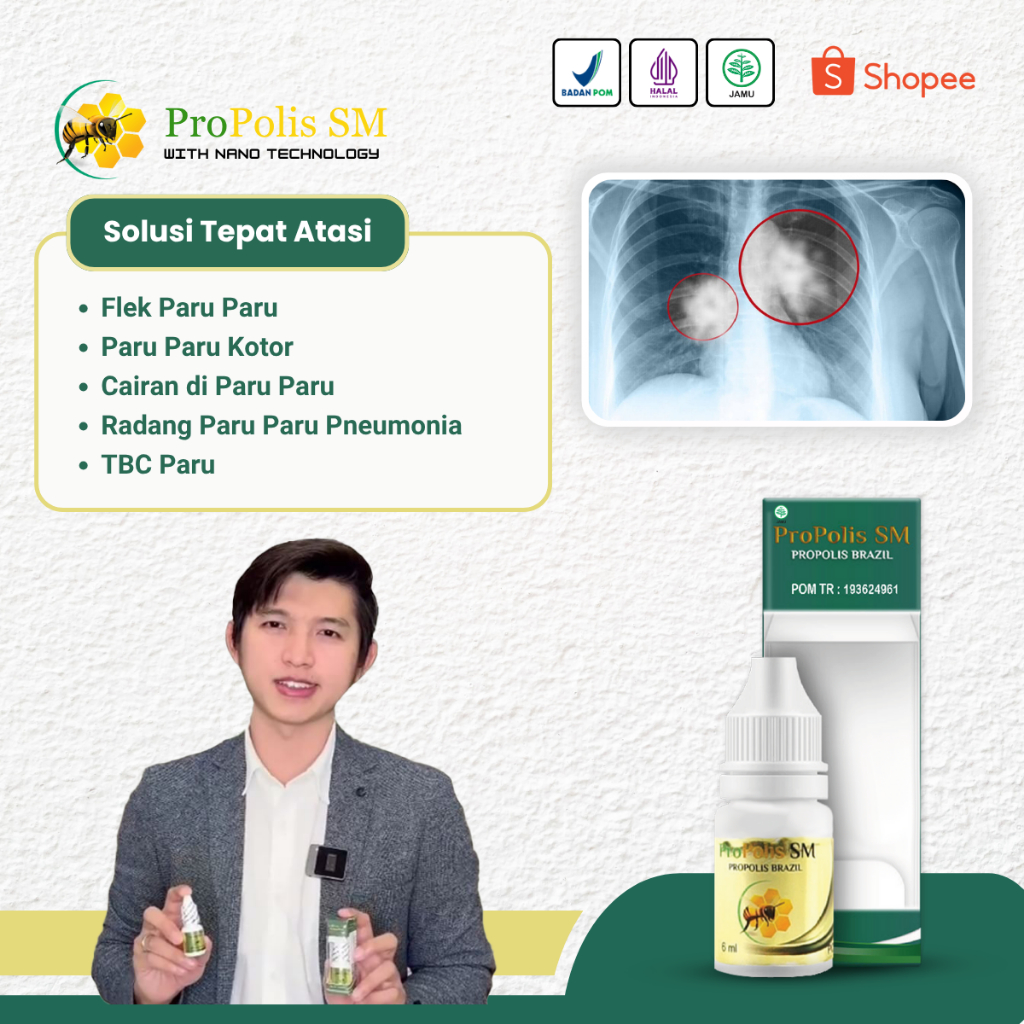 Obat Flek Paru Paru, Pembersih Paru Paru, Penghilang Cairan di Paru Paru Anak & Dewasa - Propolis SM