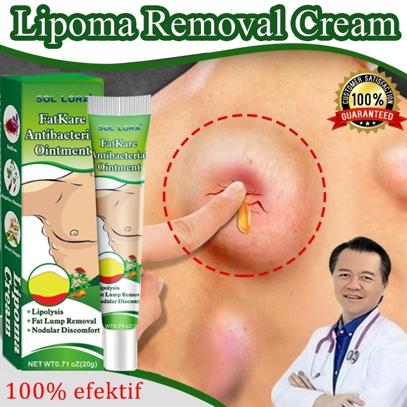 Lipoma Cream 20g salep lipoma salep benjolan Obat Lipoma Obat Benjolan Penghilang Benjolan aman dan 