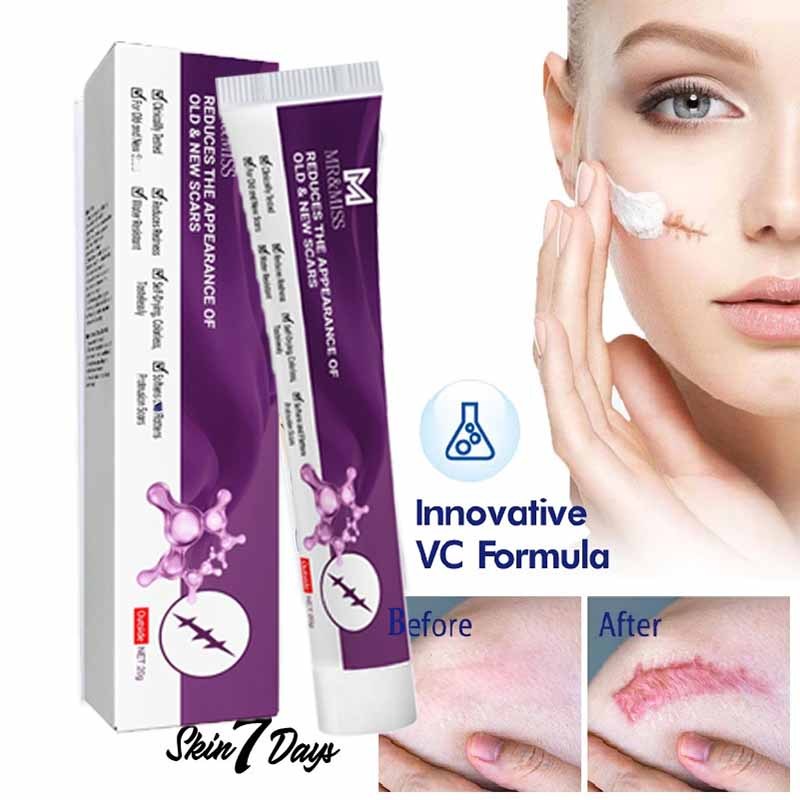 Penghilang bekas luka hitam koreng Bio herbal penghilang bekas luka Obat keloid Salep keloid paling 