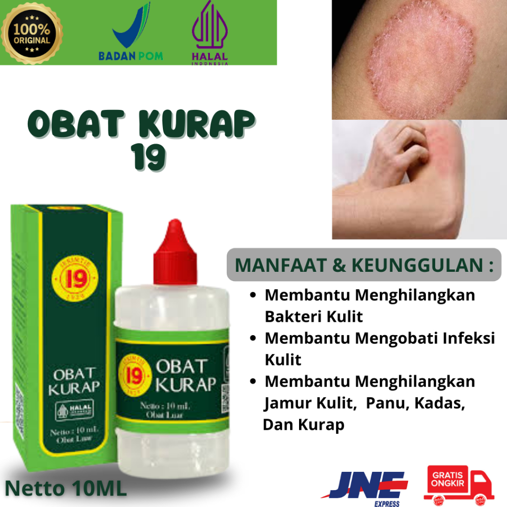 Obat Kurap 19 / Obat Kurap Ie Kim Tie