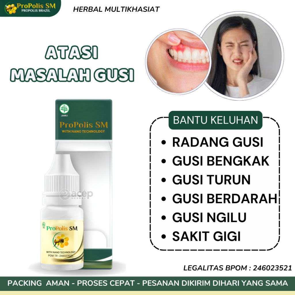 Obat Radang Gusi Gusi Bengkak Gusi Turun Gusi Berdarah Bernanah Gigi Goyang Sakit Gigi Propolis SM