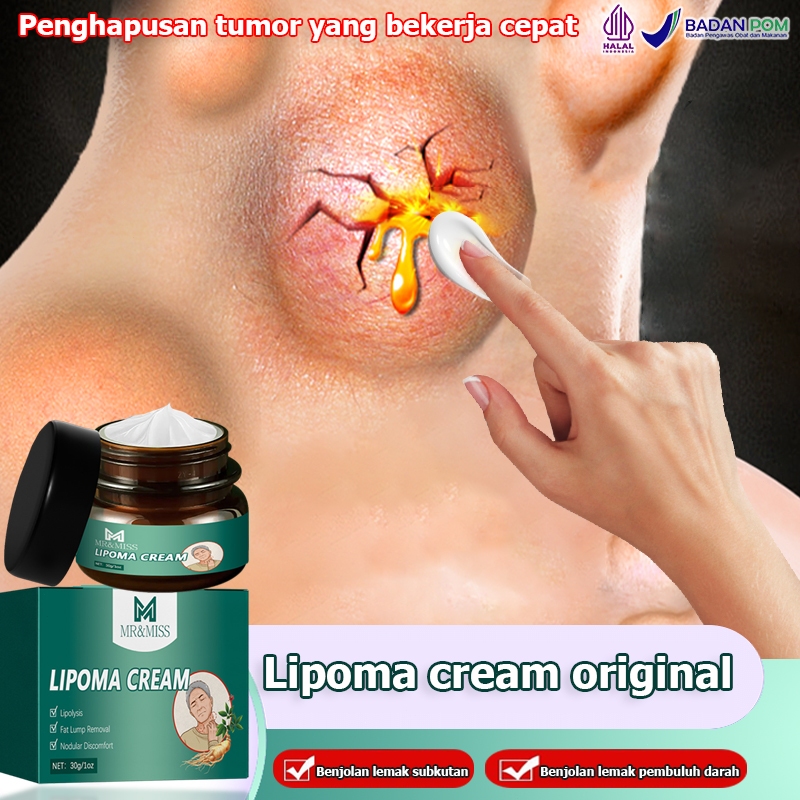 MR&MISS Lipoma cream original Obat benjolan Lipoma removal cream original Obat lipoma Salep lipoma s