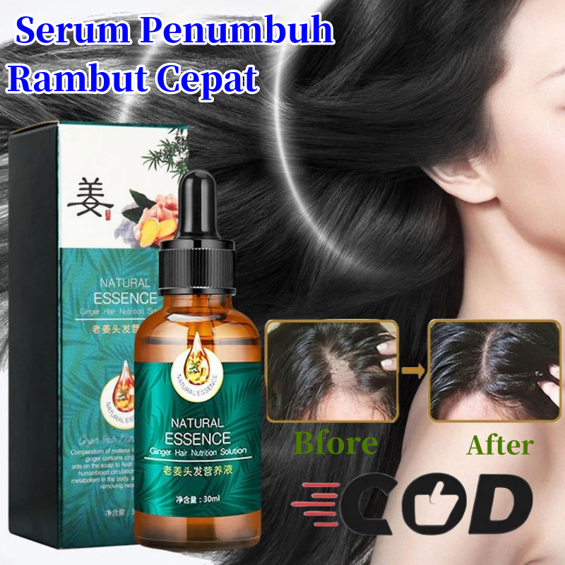 【COD ORI】ZHENXIU Serum Penumbuh Rambut Cepat Natural Beard Oil Serum Hair Growth Oil Penumbuh 7 Days