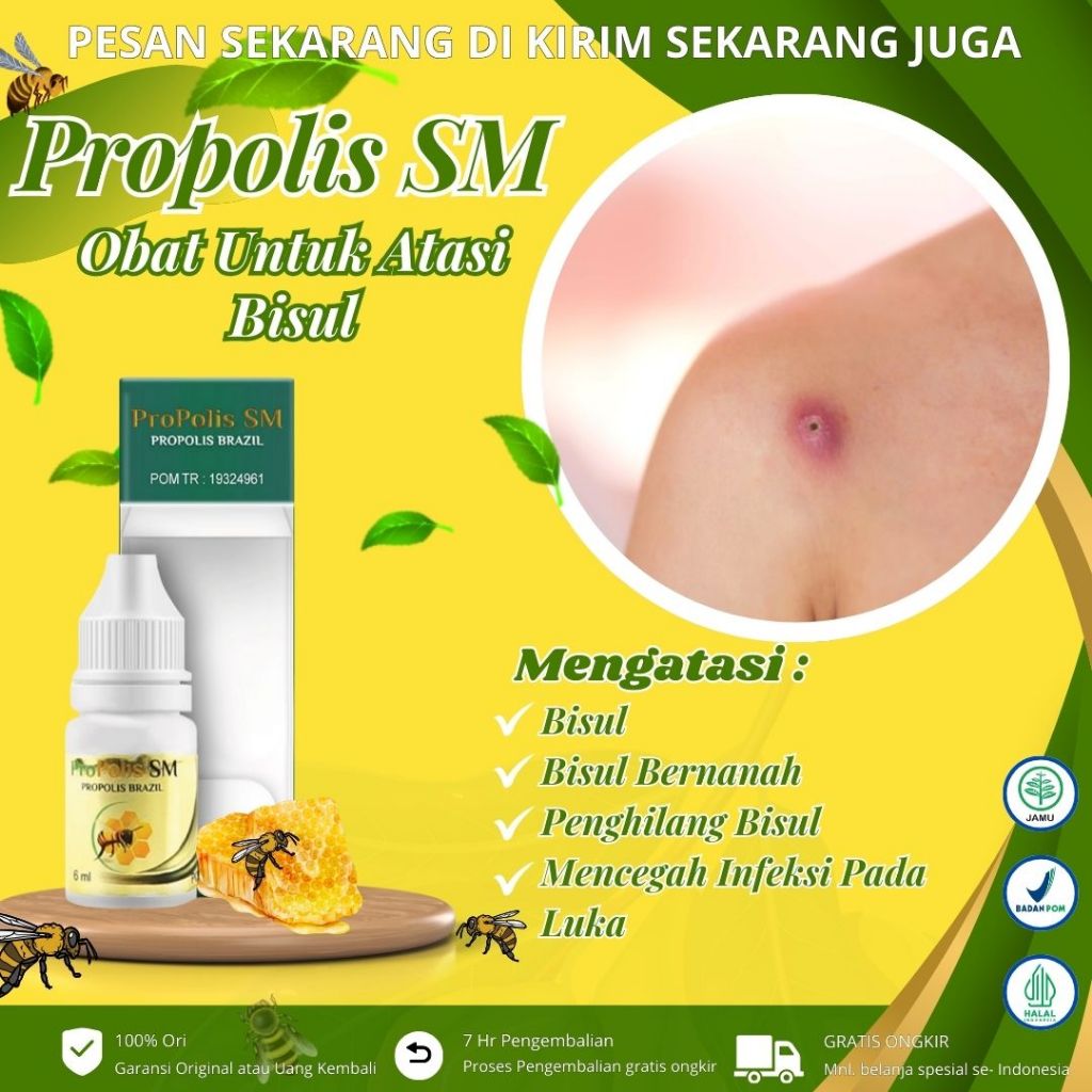 Propolis Sm - Obat Bisul, Penghilang Bisul Di Badan, Obat Tetes Bisul, Bisul Bernanah, Obat Oles Unt