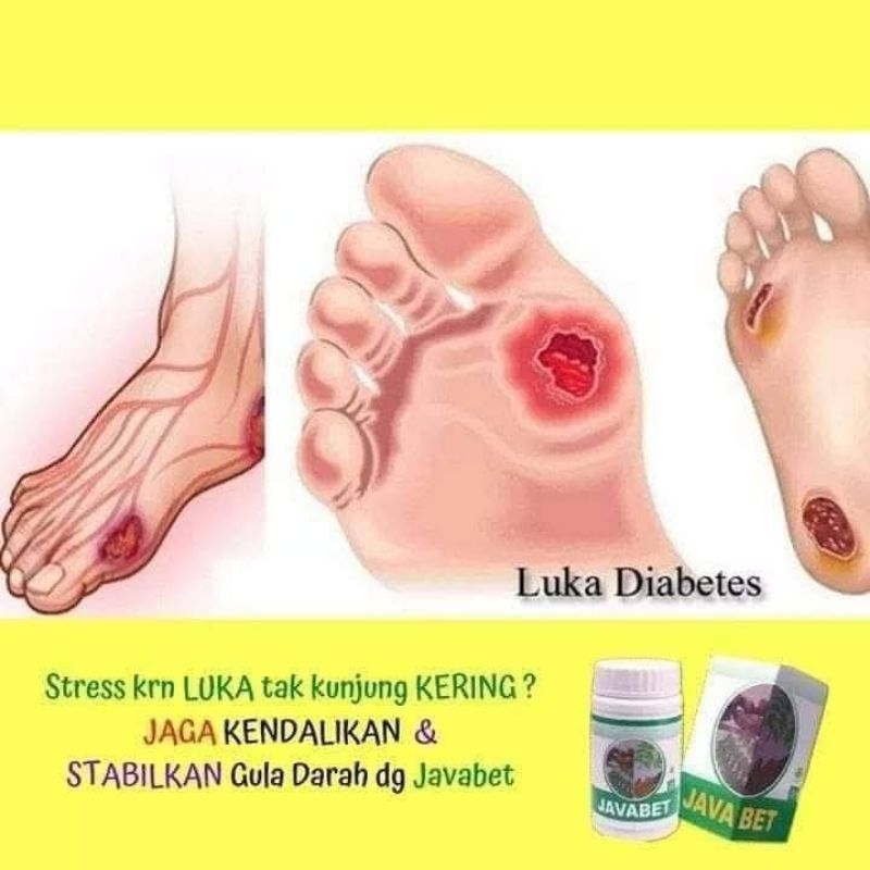 

javabet untuk diabet