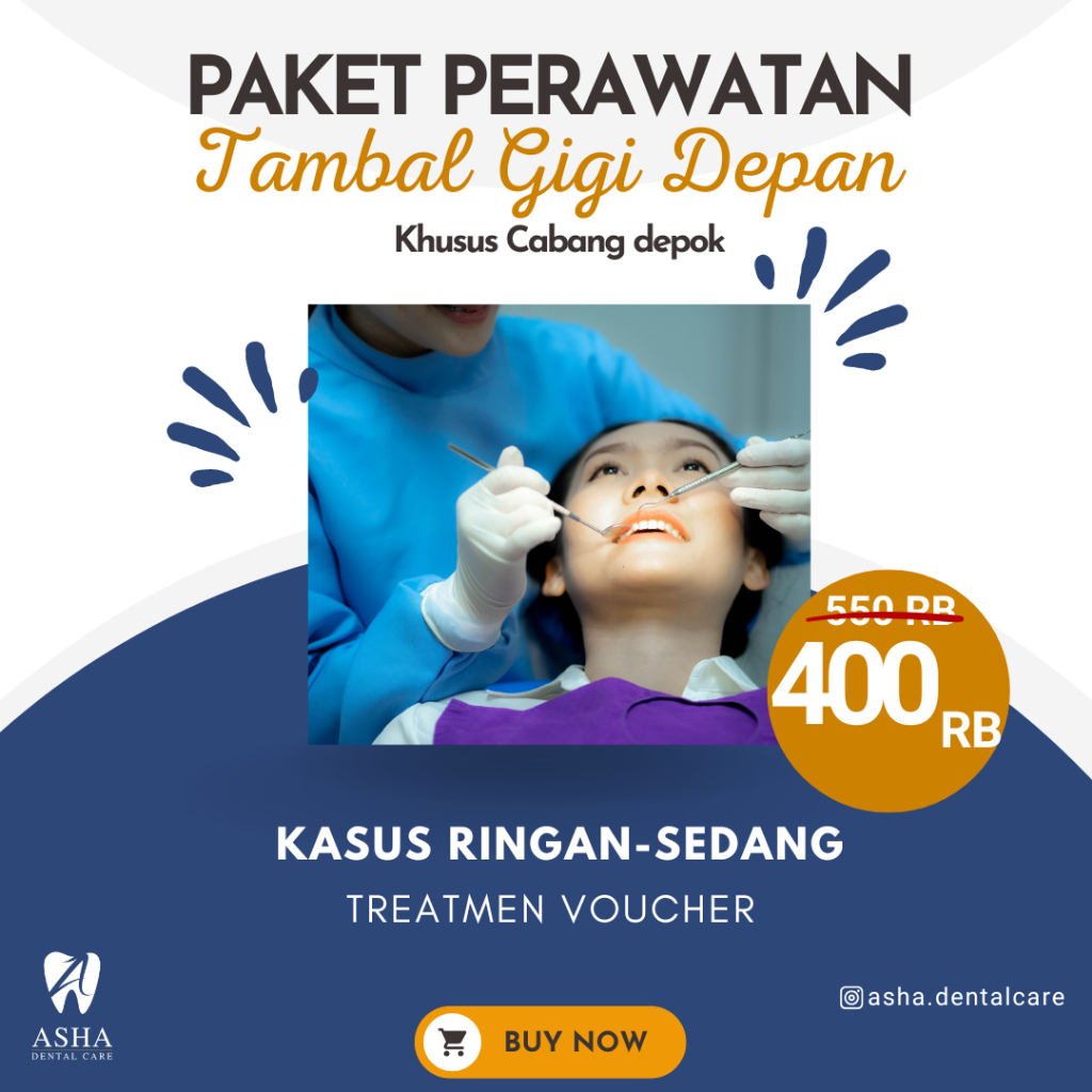 Promo Tambal Gigi Depan