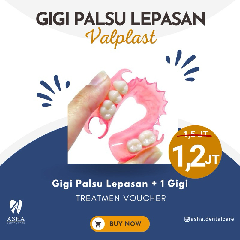 Gigi Palsu Lepasan Valplast