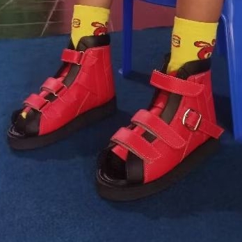 Sepatu Ortopedi Anak Murah - Koreksi Kaki Pengkor, Kaki X, Jalan Jinjit, Kaki Lumpuh