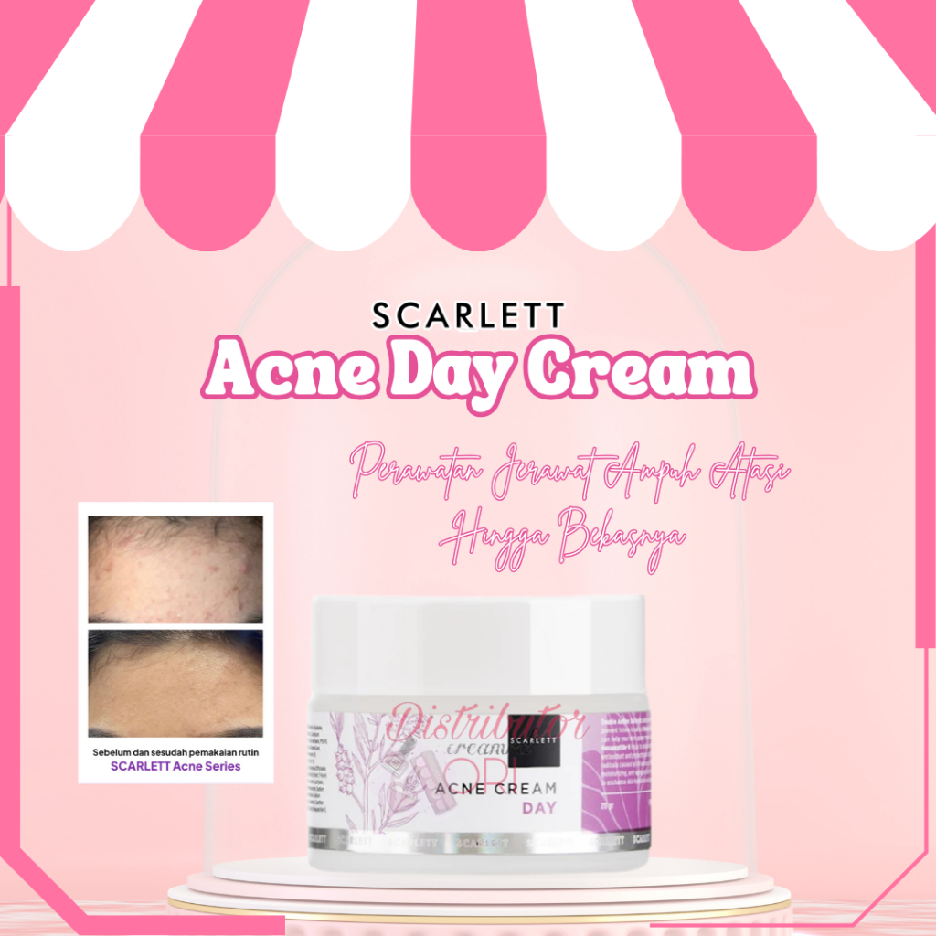 Scarlett Whitening Acne Day Cream | Day acne scralett | scarlett acne day cream