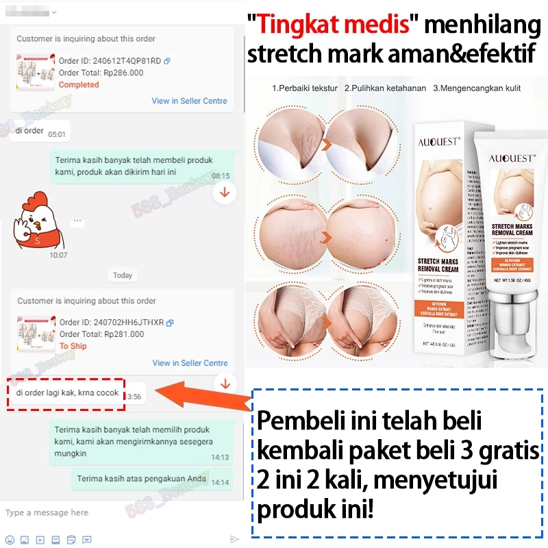 Cream Stretch Mark Paling Ampuh Perut Stretch Mark Cream Cepat Dan Permanen Penghilang Stretch Mark