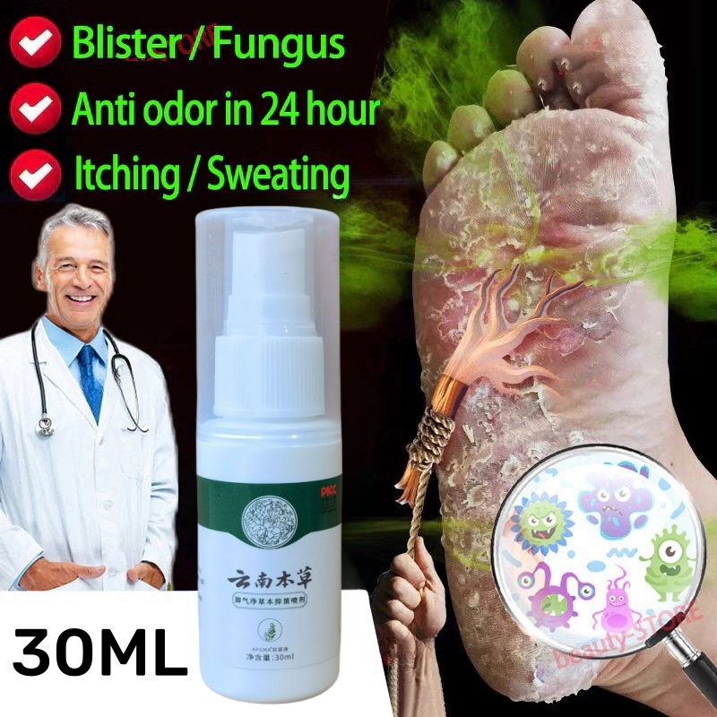 Penghilang Bau Kaki Semprotan Obat Anti Gatal Anti Bakteri Salep Gatal Paling Ampuh Mencegah Kaki Be